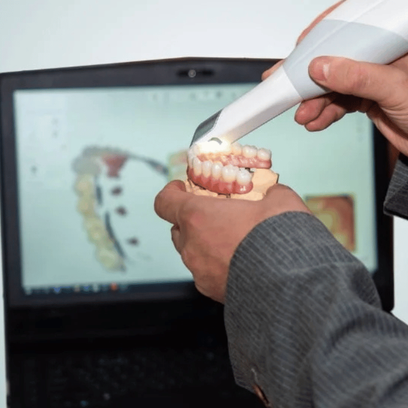 Treatment - Kingswood Dental Practice